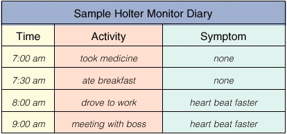 Muestra de un diario del monitor Holter